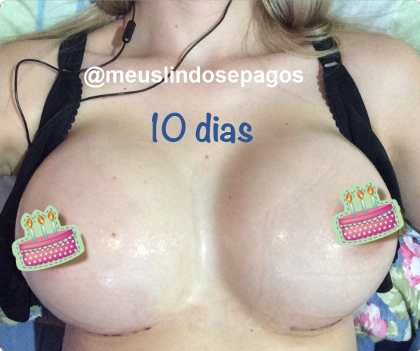 10dias